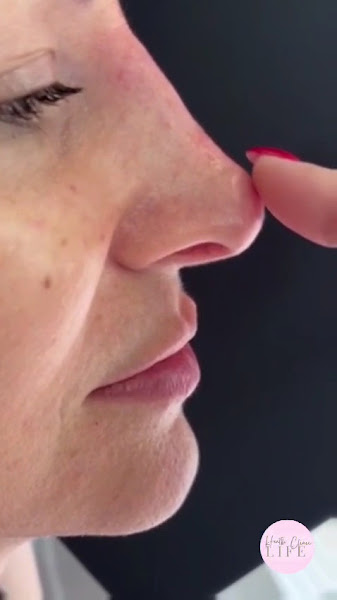 Foto 3 de Dra. Renata Marins, Especialista em Harmonização Facial Natural