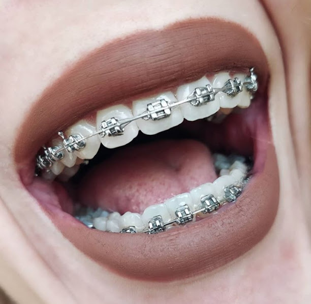 Foto 3 de Dra.Renata Recife Odontologia