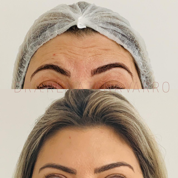 Foto 2 de Dra Renata Sarkis F. Navarro - Harmonização Facial