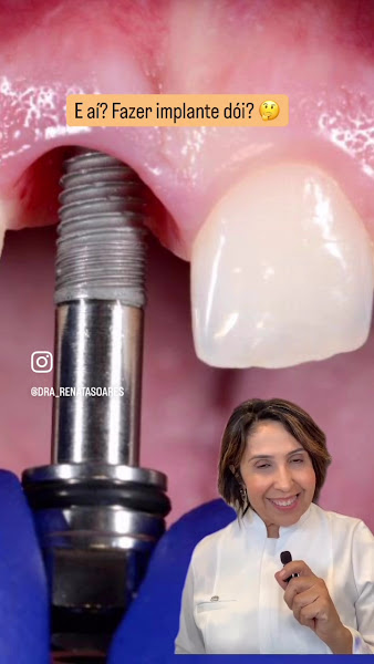 Foto 3 de Dra. Renata Soares - Protesista e Especialista em Reabilitação Oral