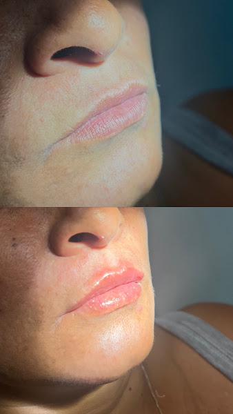 Foto 3 de Dra. Rhayelli | Dentista e Harmonização Facial.