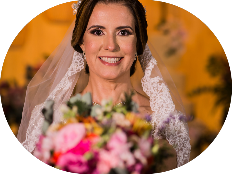 Foto 5 de Dra. Richelle Rodrigues (Dentista) Gengivoplastia . Tratamento Periodontal . Clareamento