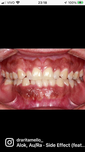 Foto 3 de Dra. Rita Mello - Odontologia • Harmonização Facial