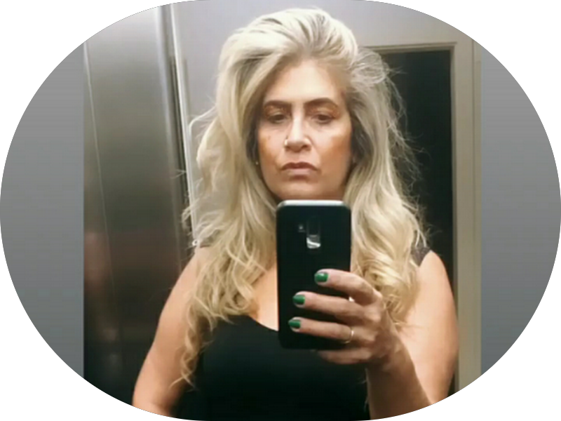 Foto 6 de Dra. Rita – Prada Odontologia | Ortodontia Preventiva e Alinhadores – Osasco