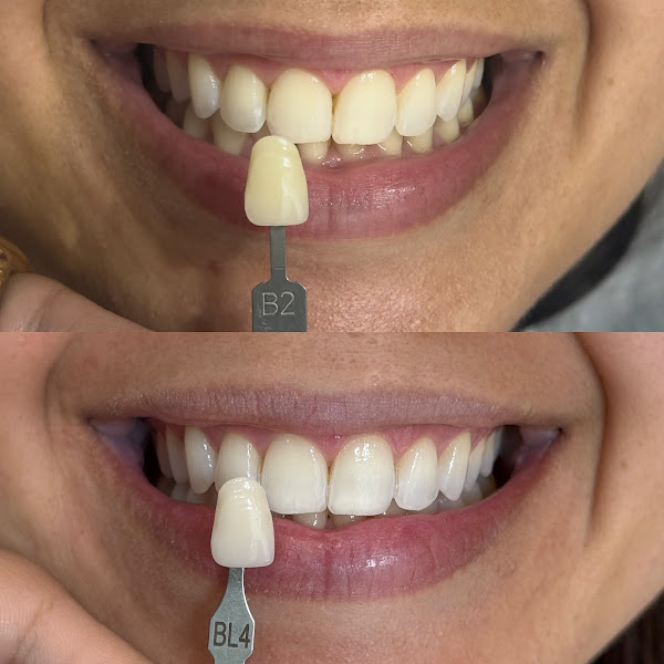 Foto 2 de Dra Rita Ventura Consultório Odontológico e Harmonização Orofacial Duque de Caxias e Barra da Tijuca