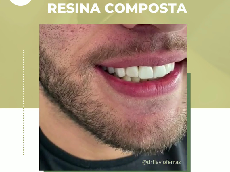 Foto 5 de Dra Roberta Bianchi - Dentista em Curitiba