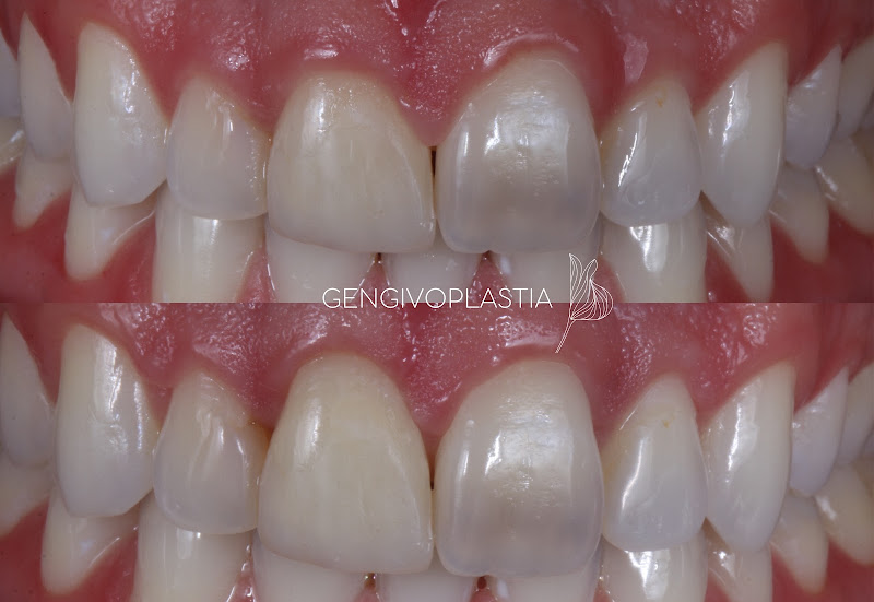 Foto 2 de Dra. Roberta Blasi - Dentista especialista em dentística restauradora, estética e preventiva