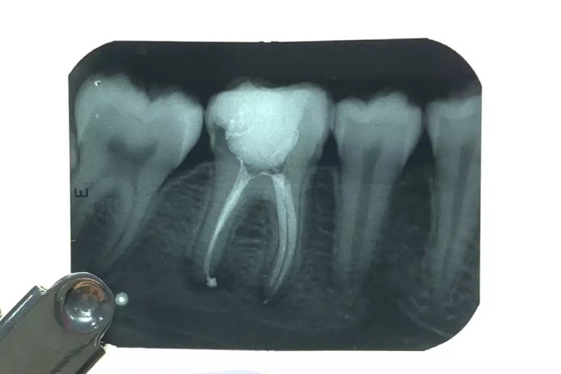 Foto 3 de Dra. Roberta Lacerda - Tratamento de Canal Dentário. Endodontia com Excelência.