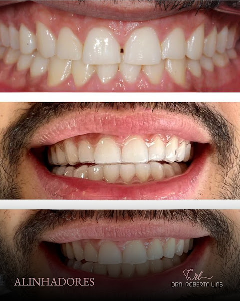 Foto 3 de Dra. Roberta Lins | Dentista - Recife