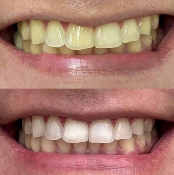 Foto 2 de Dra. Roberta Samila Vieira - Dentista em Caucaia