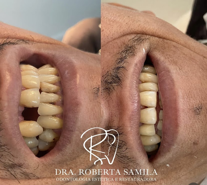 Foto 3 de Dra. Roberta Samila Vieira - Dentista em Caucaia
