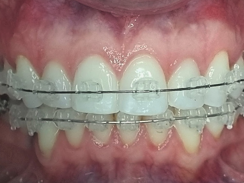 Foto 3 de Dra. Rosana Reis - Dentista