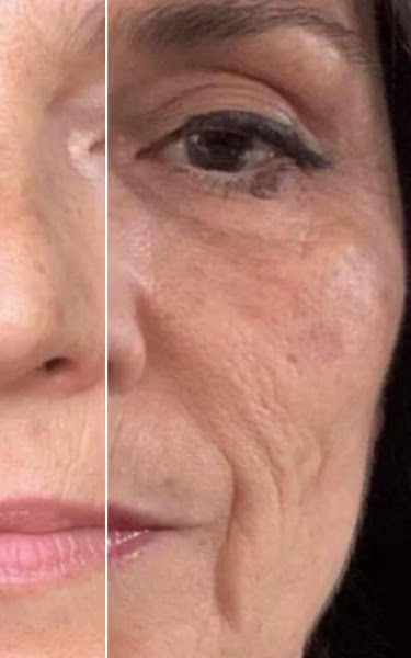 Foto 2 de Dra. Rosana Salvador | Harmonização Facial Rio de Janeiro