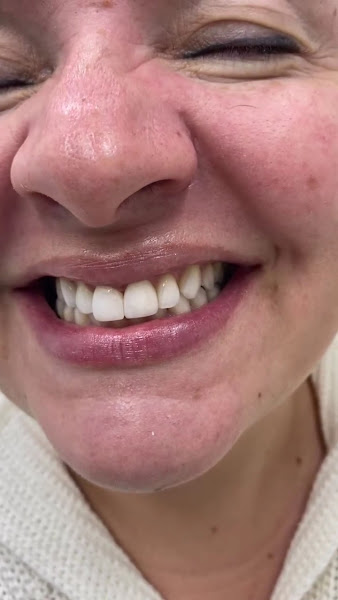 Foto 4 de Dra. Rosangela Santos | Dentista em Maceió | Facetas em Resina em Maceió