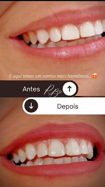 Foto 4 de Dra. Roseane Borges Dentista