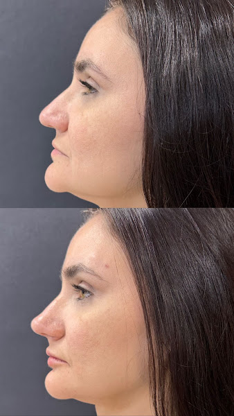 Foto 2 de Dra Sabrina Menezes - Harmonização Facial/Valadares