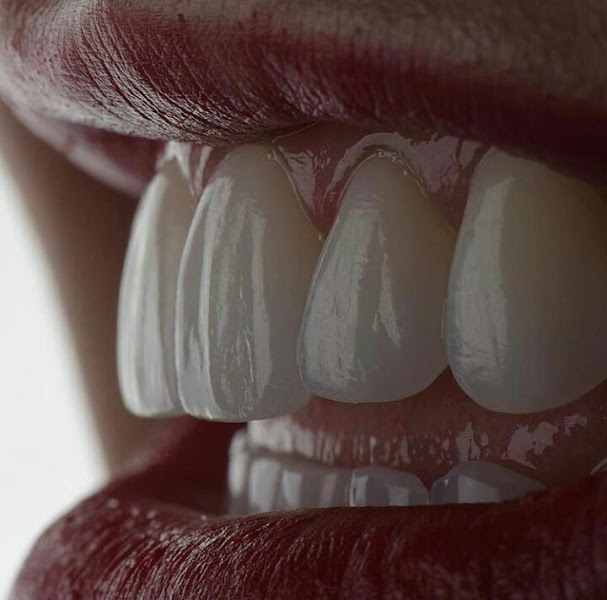 Foto 3 de Dra Sabrina Wigneron. Especialista/Mestre Implante Dentário. Especialista em Protése Dentária