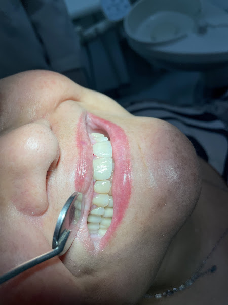 Foto 3 de Dra Samanta Delabeta- clínica DELABELA | Implantes, Próteses e Estética Dental