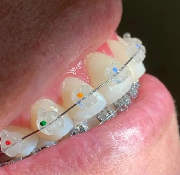 Foto 2 de DRA SAMANTHA BASILIO DENTISTA | CLAREAMENTOS FACETAS ORTODONTIA ESTÉTICA - UNIDADE LESTE SÃO JOÃO