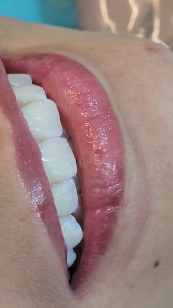Foto 3 de DRA SAMANTHA BASILIO DENTISTA | CLAREAMENTOS FACETAS ORTODONTIA ESTÉTICA - UNIDADE LESTE SÃO JOÃO