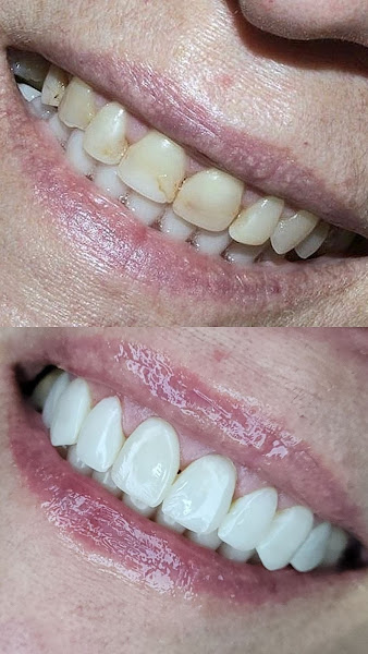 Foto 2 de Dra Samantha Fernandes - Sorri Comigo Odontologia