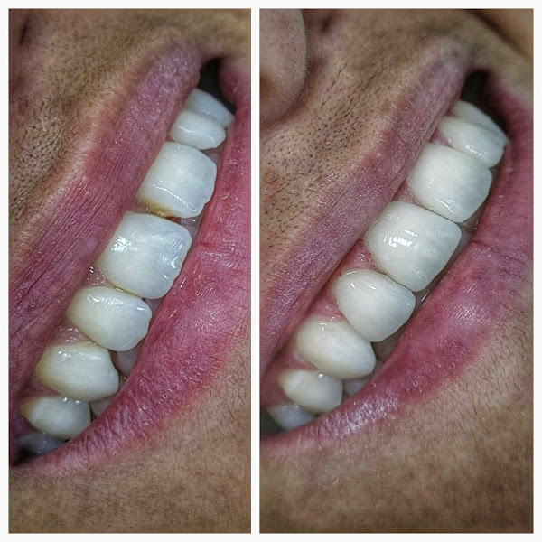 Foto 3 de Dra Samantha Fernandes - Sorri Comigo Odontologia