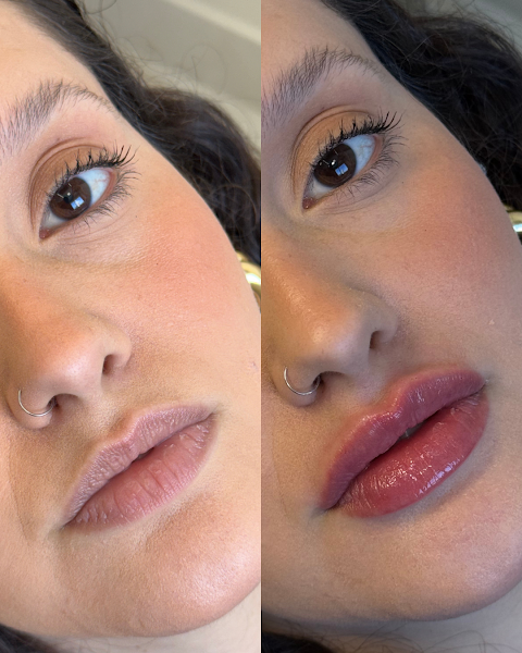 Foto 3 de Dra. Samantha Pigati | Harmonização Facial