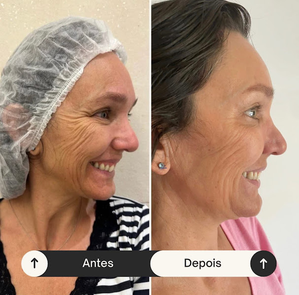 Foto 3 de Dra. Samantha Souza - Harmonização Facial