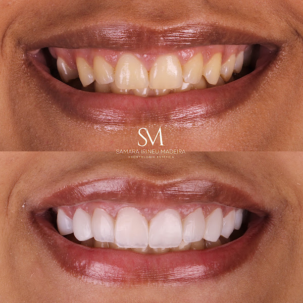 Foto 2 de Dra Samara Irineu Madeira - SM odontologia estética