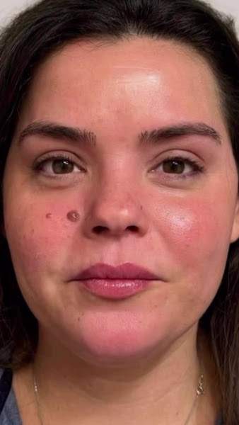 Foto 3 de Dra Samira Galvani - Harmonização Facial em Piracicaba