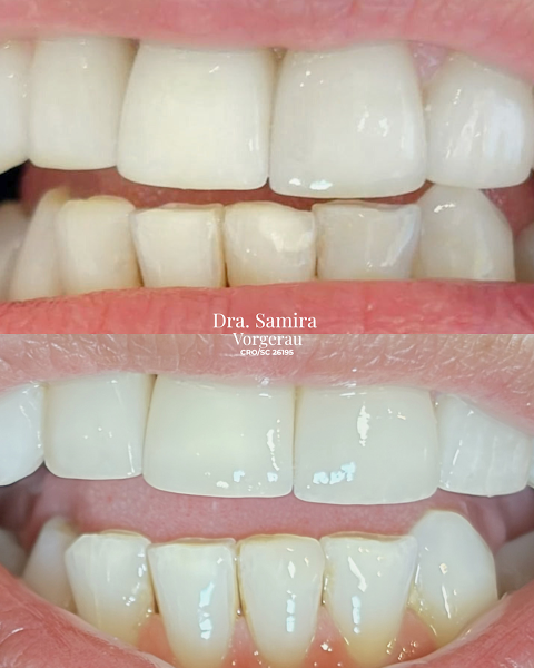 Foto 2 de Dra. Samira Vorgerau - Dentista em Brusque