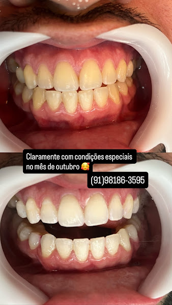 Foto 2 de Dra. Samylla Gonçalves CIRURGIÃ-DENTISTA