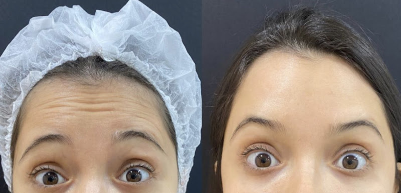 Foto 2 de Dra Sandra Maeta -Harmonização orofacial