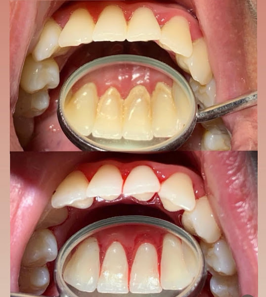 Foto 2 de Dra Sara Cristina de Oliveira Lemes Melo - Cirurgiã Dentista