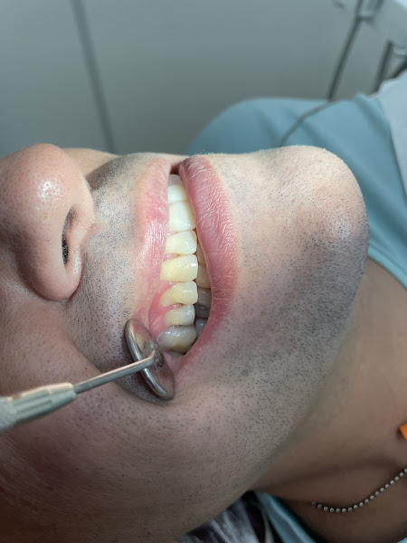 Foto 3 de Dra Sara Cristina de Oliveira Lemes Melo - Cirurgiã Dentista