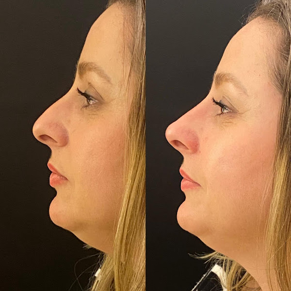 Foto 2 de Dra. Sarah Amábille | Estética e Harmonização Facial | Botox |Rinomodelação| Preenchimento labial | Localizada em Indaiatuba