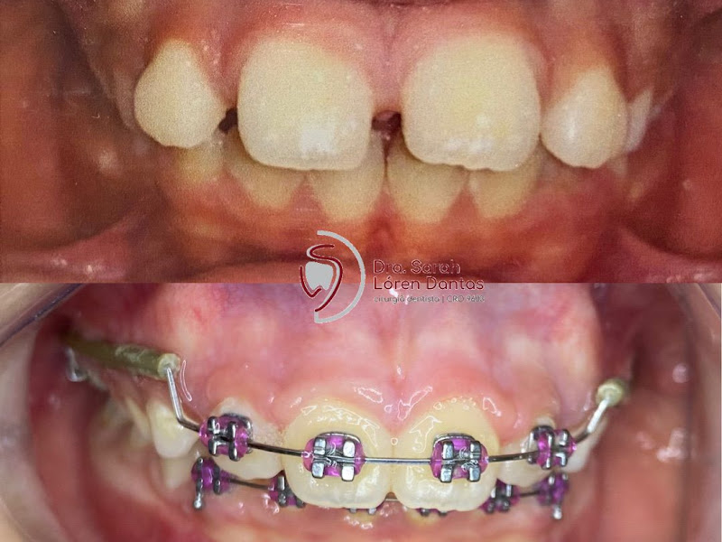 Foto 3 de Dra Sarah Falconeri Odontologia