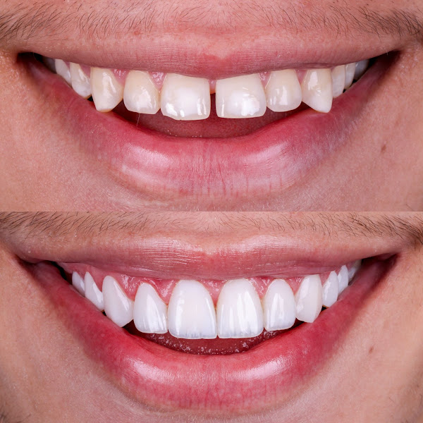 Foto 2 de Dra. Sheila Carvalho - Cirurgiã-Dentista