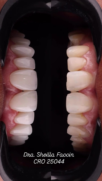 Foto 4 de Dra. Sheilla Faccin | Dentista no Cabral