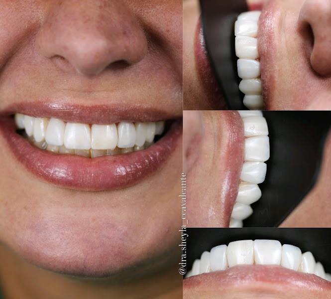 Foto 2 de Dra Sheyla Cavalcante especialista em Implantodontia