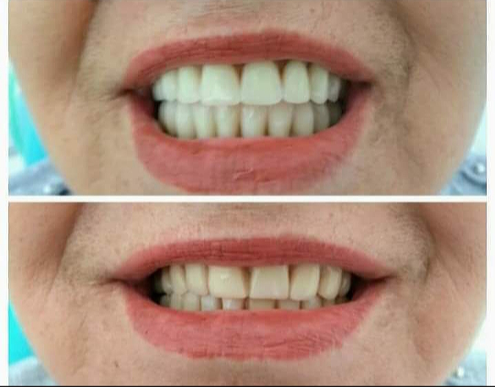 Foto 2 de Dra Silvana Pieroni Odonto Glicério