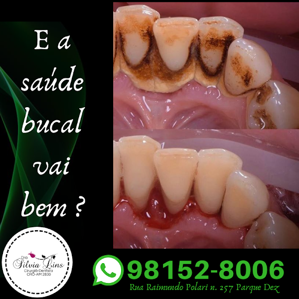 Foto 2 de Dra Silvia Lins Harmonização Orofacial