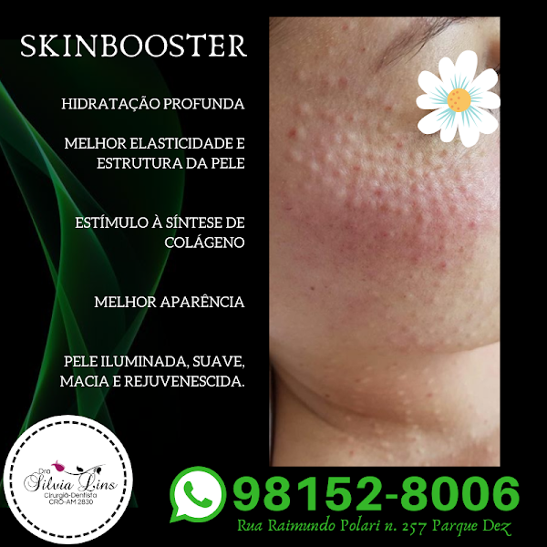 Foto 3 de Dra Silvia Lins Harmonização Orofacial