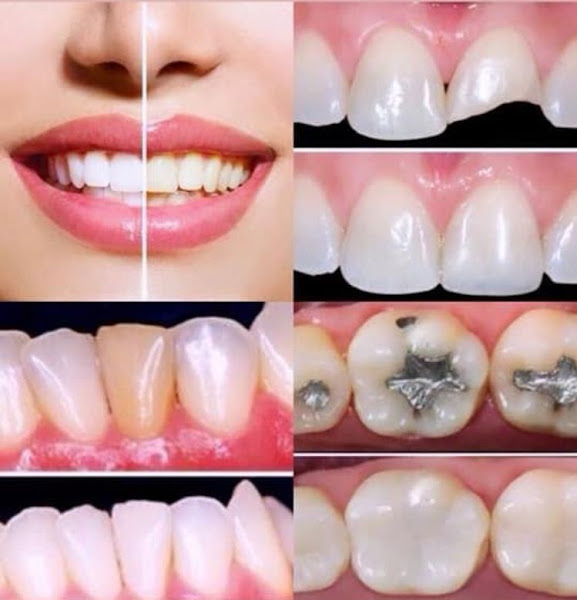 Foto 3 de Dra. Silvia Magalhães Giannetto | Dentista em Interlagos / Jardim Suzana