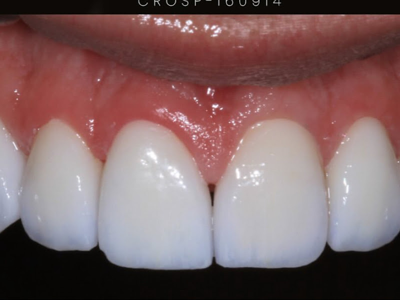 Dra. Silvia Regina Gaspar de Castro e Dra.Ana Carolina Novo de Castro