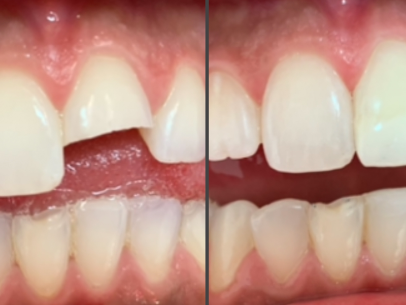 Foto 8 de Dra. Silvia Satriuc - Odontologia