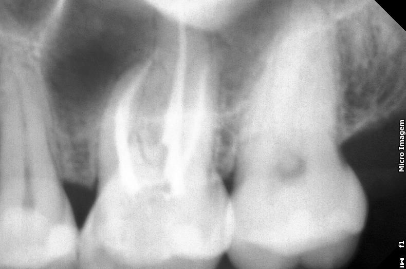 Foto 3 de Dra Simone Argenta Scalabrin -Invisalign®️Dr - Endodontista