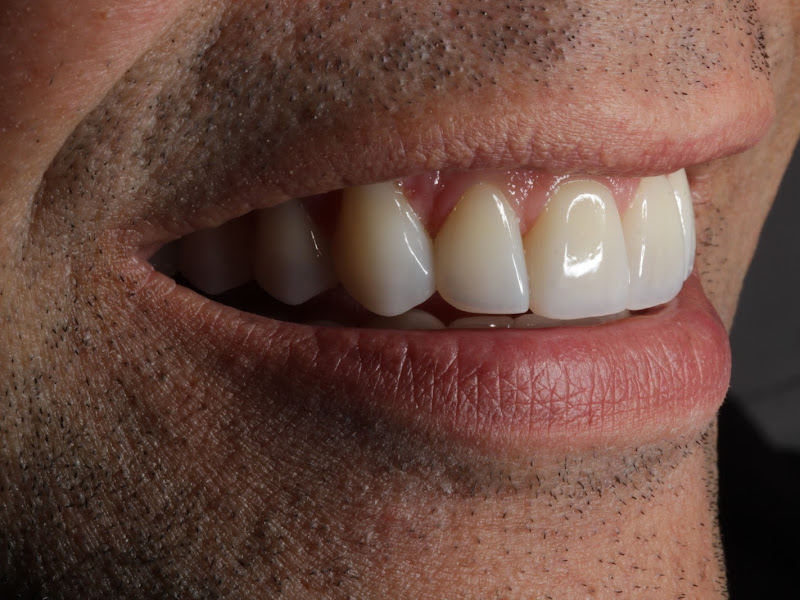 Foto 10 de Dra. Simone Baezo Rassy - Odontologia e Estética | Morumbi - SP