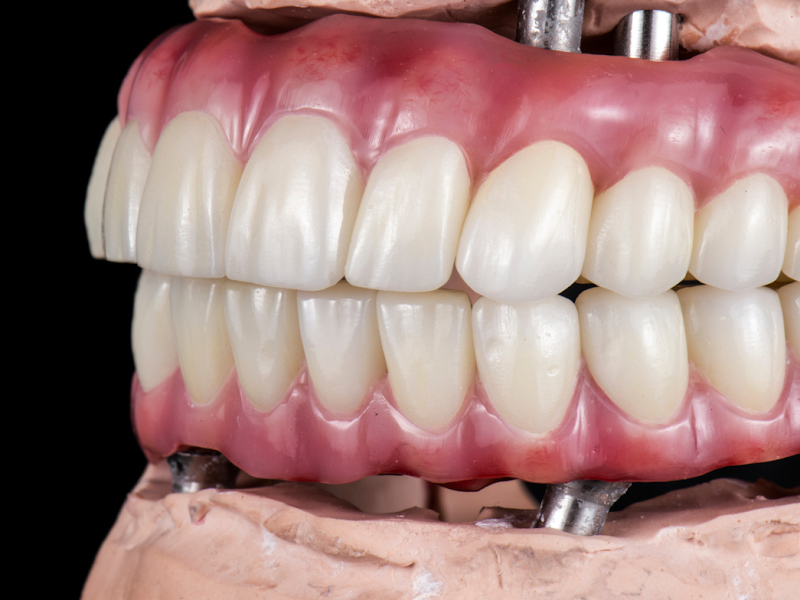 Foto 2 de Dra.Simone Ribeiro Odontologia