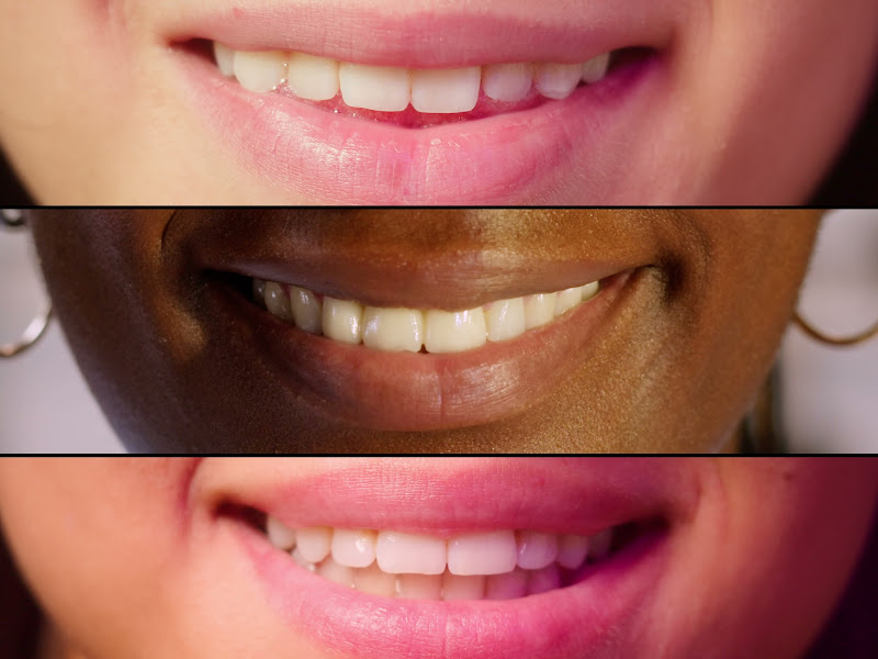 Foto 3 de Dra Sônia Valentoni Guelfi Odontologia | Dentista no Bairro Saúde | Praça da Árvore